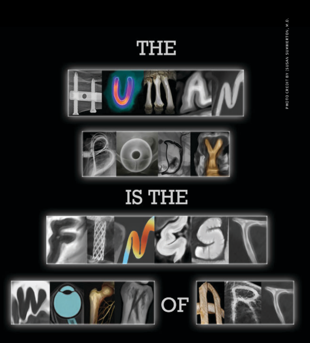 X-Ray Artiste